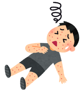 ティッシュを使用するだけでアレルギーが発生する理由