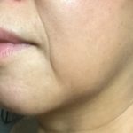 アンチエイジングの基礎知識!ほうれい線のしわを目立たなくする方法!